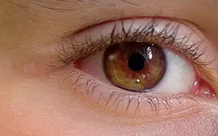 ഇടതുകണ്ണിന് നൽകേണ്ട ചികിത്സ വലതുകണ്ണിന് ചെയ്തു; തിരുവനന്തപുരത്ത് ഡോക്ടർക്ക് സസ്പെൻഷൻ