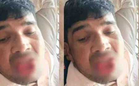 കടന്നു പിടിച്ചു, ബലം പ്രയോഗിച്ച് ചുംബിച്ചു; മുൻ കാമുകന്റെ നാക്ക് കടിച്ചു മുറിച്ച് യുവതി