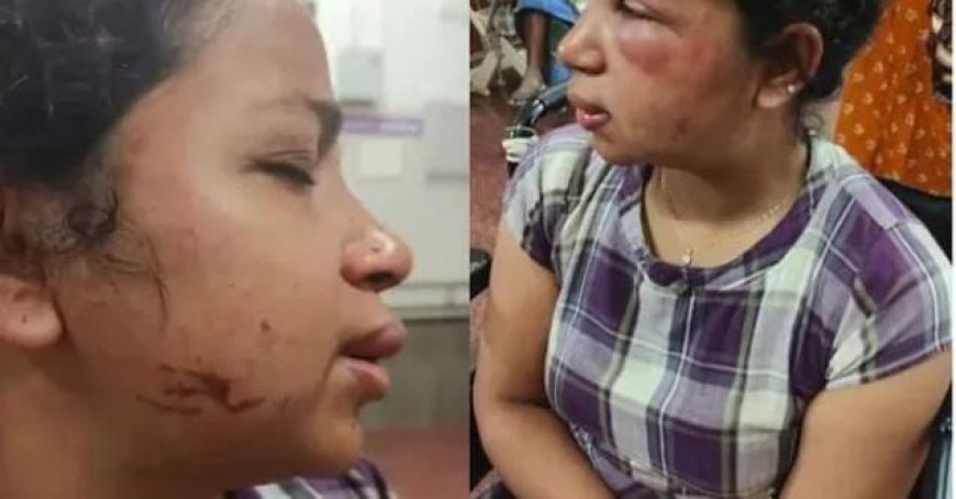 യുവതിയോട് തന്റെ ജീവിതത്തിൽ നിന്ന് ഒഴിഞ്ഞുപോകണമെന്നാവ ശ്യപ്പെട്ട് അതി ക്രൂരമായി മർദ്ദിച്ച് ഭർത്താവ്, മൂന്ന് കുട്ടികളെയും കൂട്ടി ആത്മഹത്യ ചെയ്യാൻ പറഞ്ഞായിരുന്നു ഭർത്താവിന്റെ മർദ്ദനമെന്ന് രമ്യ : സംഭവം കോട്ടയത്ത്