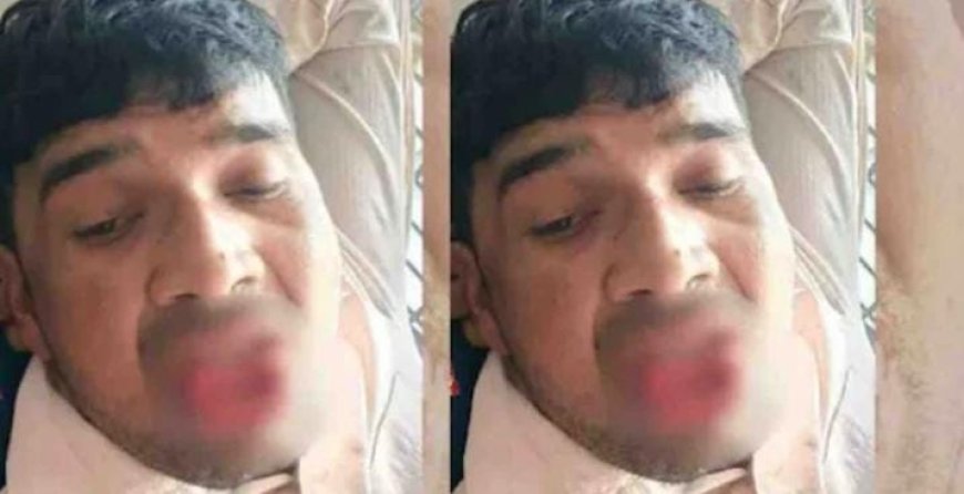 കടന്നു പിടിച്ചു, ബലം പ്രയോഗിച്ച് ചുംബിച്ചു; മുൻ കാമുകന്റെ നാക്ക് കടിച്ചു മുറിച്ച് യുവതി