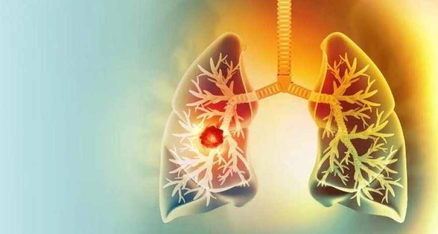 ശ്വാസകോശ ക്യാൻസർ ; ശരീരം കാണിക്കുന്ന ഏഴ് ലക്ഷണങ്ങൾ