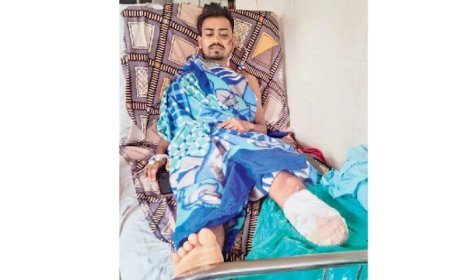 മുംബൈയിൽ ഫോൺ മോഷണം തടയുന്നതിനിടെ ട്രെയിനിൽ നിന്നും വീണ് യുവാവിന്റെ കാൽ നഷ്ടപ്പെട്ടു ‌‌