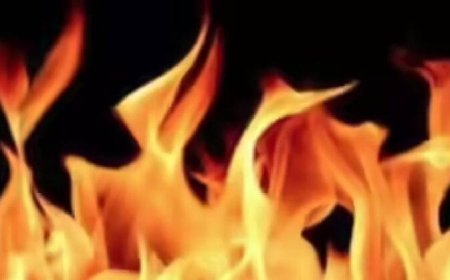 *ആറ്റുകാൽ പൊങ്കാലയിടുന്നതിനിടെ പൊള്ളലേറ്റു; ചികിത്സയിലായിരുന്ന / കോഴിക്കോട് സ്വദേശിനി മരിച്ചു* 